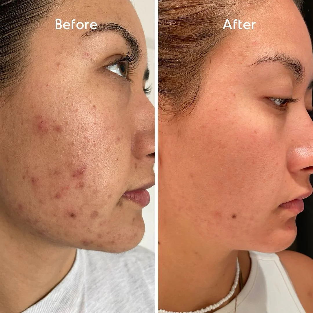 Lumie™ Sonic Glow  Wand