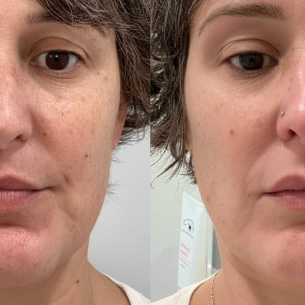 Lumie™ Sonic Glow  Wand