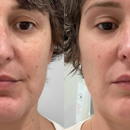 Lumie™ Sonic Glow  Wand