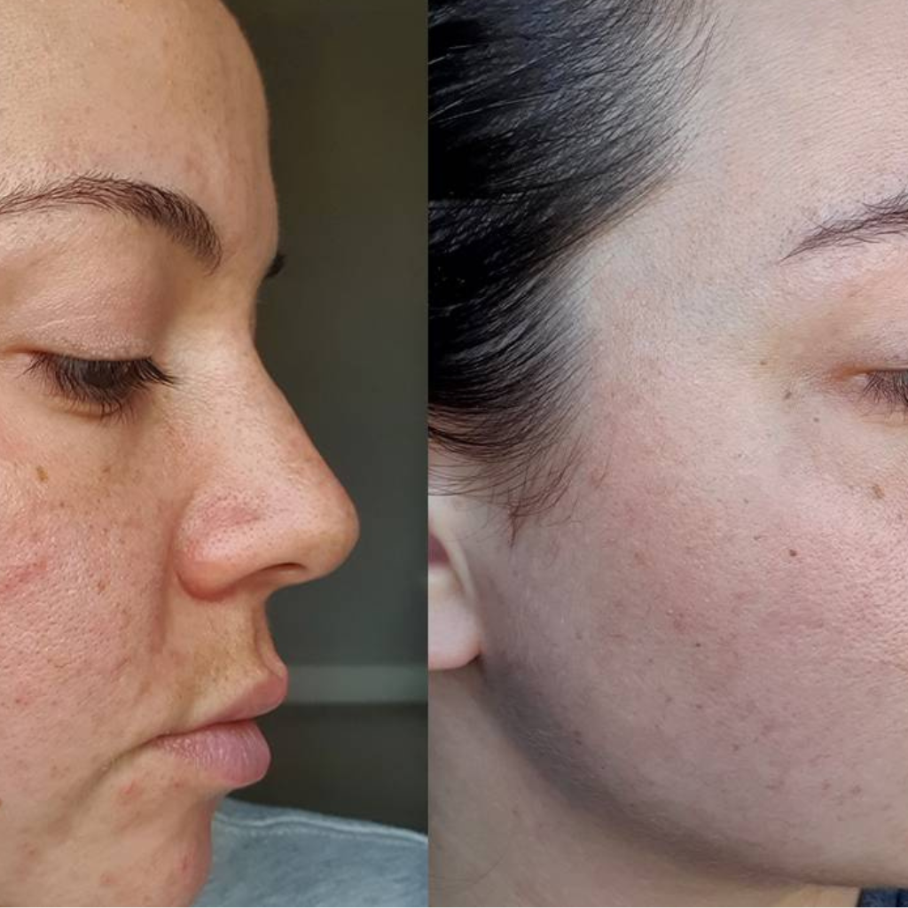 Lumie™ Sonic Glow  Wand